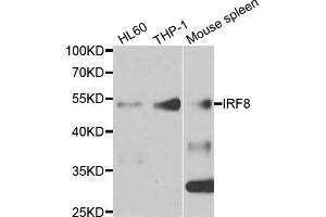Western blot analysis of extracts of various cell lines, using IRF8 antibody. (IRF8 Antikörper)