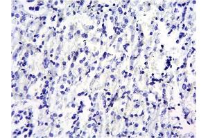 Immunohistochemistry (IHC) image for anti-Suppressor of Cytokine Signaling 1 (SOCS1) (C-Term) antibody (ABIN184575)