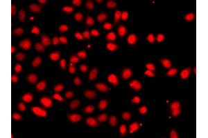 Immunofluorescence analysis of  cells using EP/HIF2α antibody (ABIN6127869, ABIN6141764, ABIN6141765 and ABIN6223457). (EPAS1 Antikörper  (AA 588-870))