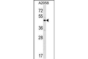 Western blot analysis in A2058 cell line lysates (35ug/lane). (XKR3 Antikörper  (C-Term))