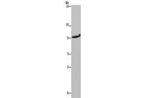Western Blotting (WB) image for anti-Mitogen-Activated Protein Kinase Kinase Kinase 11 (MAP3K11) antibody (ABIN2433391) (MAP3K11 Antikörper)