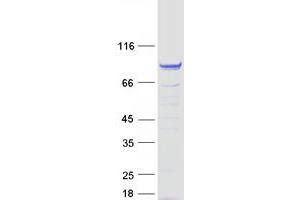 Western Blotting (WB) image for Fibrous Sheath Interacting Protein 1 (FSIP1) protein (Myc-DYKDDDDK Tag) (ABIN2721178)