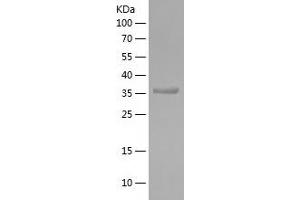 LC3B Protein (AA 1-107) (His-IF2DI Tag)