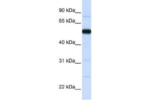 THUMPD2 antibody used at 1 ug/ml to detect target protein. (THUMPD2 Antikörper  (N-Term))