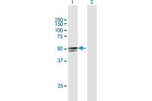 Western Blot analysis of ANKDD1A expression in transfected 293T cell line by ANKDD1A MaxPab polyclonal antibody. (ANKDD1A Antikörper  (AA 1-423))