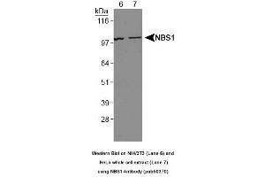 Image no. 2 for anti-NLR Family, Pyrin Domain Containing 2 (NLRP2) (AA 150-200) antibody (ABIN363677) (NLRP2 Antikörper  (AA 150-200))