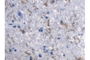 DAB staining on IHC-P; Samples: Rat Spinal cord Tissue (RANKL Antikörper  (AA 106-240))