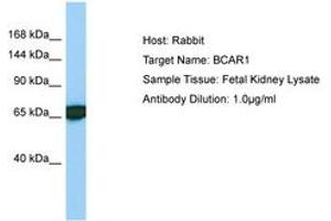 Image no. 1 for anti-Breast Cancer Anti-Estrogen Resistance 1 (BCAR1) (AA 456-505) antibody (ABIN6749973) (BCAR1 Antikörper  (AA 456-505))