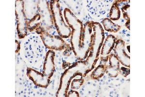 Anti-SLC22A6 antibody, IHC(P) IHC(P): Rat Kidney Tissue (SLC22A6 Antikörper  (C-Term))