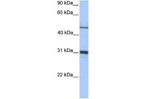EPHX1 antibody used at 1 ug/ml to detect target protein. (EPHX1 Antikörper)
