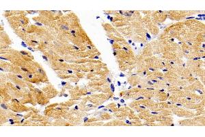 Detection of MMP9 in Rabbit Cardiac Muscle Tissue using Polyclonal Antibody to Matrix Metalloproteinase 9 (MMP9)