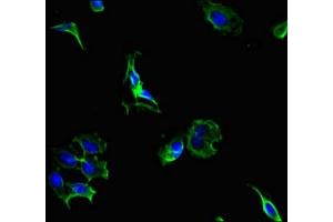 Immunofluorescent analysis of Hela cells using ABIN7164820 at dilution of 1:100 and Alexa Fluor 488-congugated AffiniPure Goat Anti-Rabbit IgG(H+L) (PCSK5 Antikörper  (AA 201-500))