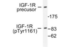 Image no. 1 for anti-Insulin-Like Growth Factor 1 Receptor (IGF1R) (pTyr1161) antibody (ABIN318045) (IGF1R Antikörper  (pTyr1161))