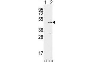 Western Blotting (WB) image for anti-SET Domain Containing 8 Pseudogene 1 (SETD8P1) antibody (ABIN2996451) (SET7 Antikörper)