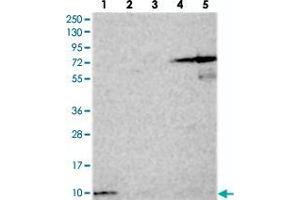 Western blot analysis of Lane 1: RT-4, Lane 2: U-251 MG, Lane 3: Human Plasma, Lane 4: Liver, Lane 5: Tonsil with HIGD1A polyclonal antibody  at 1:250-1:500 dilution. (HIGD1A Antikörper)