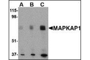 Western blot analysis of MAPKAP1 in human skeletal muscle tissue lysate with this product at (A) 0. (Transportin 1 Antikörper  (N-Term))