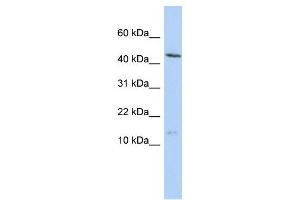 MYL6 antibody used at 1 ug/ml to detect target protein. (MYL6 Antikörper  (N-Term))
