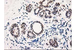Immunohistochemical staining of paraffin-embedded Human breast tissue using anti-TP53I3 mouse monoclonal antibody. (TP53I3 Antikörper)