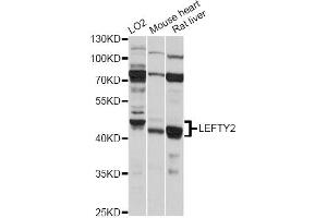 Western blot analysis of extracts of various cell lines, using LEFTY2 antibody (ABIN6292173) at 1:1000 dilution. (LEFTY2 Antikörper)