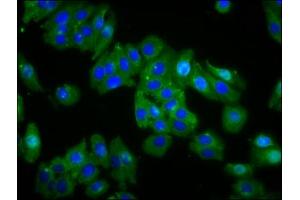 Immunofluorescence staining of HepG2 cells with ABIN7159174 at 1:66, counter-stained with DAPI. (OPN1MW Antikörper  (AA 1-52))