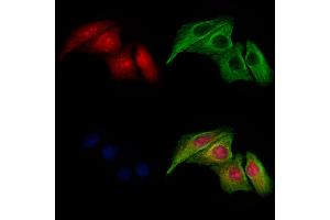 ABIN6265840 and ABIN6277615 staining Hela cells by IF/ICC. (UBD Antikörper  (Internal Region))