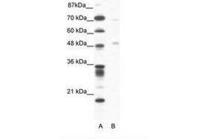 Image no. 1 for anti-Pancreatic Lipase (PNLIP) (AA 364-413) antibody (ABIN202588)
