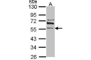 WB Image Sample (30 ug of whole cell lysate) A: IMR32 10% SDS PAGE antibody diluted at 1:1000 (ALDH1A2 Antikörper)