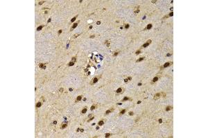 Immunohistochemistry of paraffin-embedded mouse brain using HMG20A antibody (ABIN5974388) at dilution of 1/100 (40x lens). (HMG20A Antikörper)