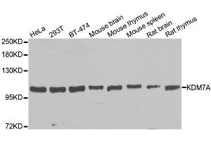 Western blot analysis of extracts of various cell lines, using KDM7A antibody. (JHDM1D Antikörper  (AA 417-735))
