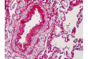 Anti-Elastin antibody IHC of human lung. (Elastin Antikörper)