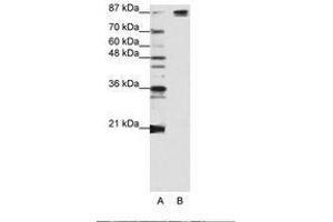 Image no. 2 for anti-Pre-mRNA Branch Site Protein p14 (SF3B14) (AA 90-139) antibody (ABIN203256) (Pre-mRNA Branch Site Protein p14 (SF3B14) (AA 90-139) Antikörper)