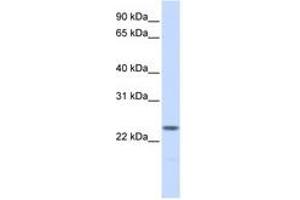 Image no. 1 for anti-Nucleophosmin/nucleoplasmin 2 (NPM2) (AA 36-85) antibody (ABIN6741439) (NPM2 Antikörper  (AA 36-85))