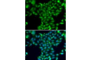 Immunofluorescence analysis of U20S cell using TGM5 antibody. (Transglutaminase 5 Antikörper)