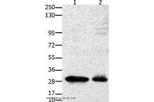 Western blot analysis of 231 cell and mouse testis tissue, using GNRHR Polyclonal Antibody at dilution of 1:2350 (GNRHR Antikörper)