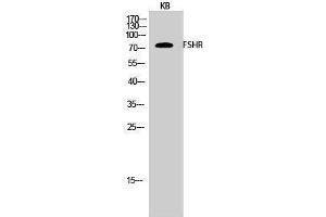 Western Blotting (WB) image for anti-Follicle Stimulating Hormone Receptor (FSHR) (Internal Region) antibody (ABIN3184700)