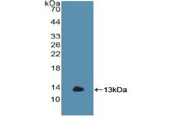 GBA anticorps  (AA 117-214)