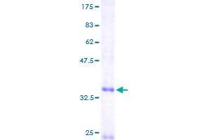 Image no. 1 for Chemokine (C-X-C Motif) Ligand 14 (CXCL14) (AA 1-111) protein (GST tag) (ABIN1350818) (CXCL14 Protein (AA 1-111) (GST tag))