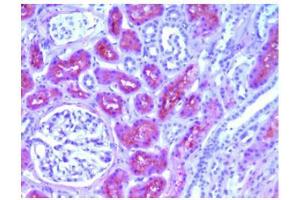 Immunohistochemical analysis of Human L-FABP in Paraffin Embedded Human kidney tissue using FABP1 Antibody Cat. (FABP1 Antikörper)