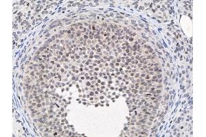 ABIN6264195 and ABIN6266861 at 1/100 staining Rat ovarian tissue by IHC-P.