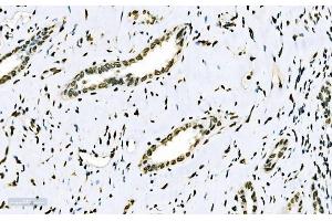 IHC analysis of splicing factor 1 using anti-splicing factor 1 antibody (ABIN7600193).