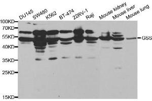 Western blot analysis of extracts of various cell lines, using GSS antibody. (Glutathione Synthetase Antikörper  (AA 1-474))