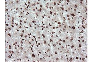 Image no. 6 for anti-Tripartite Motif Containing 38 (TRIM38) (AA 1-265) antibody (ABIN1490681)
