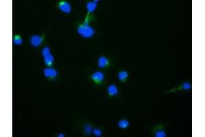 Image no. 4 for anti-Trafficking Protein Particle Complex 4 (TRAPPC4) antibody (ABIN1501264) (TRAPPC4 Antikörper)