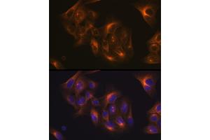 Immunofluorescence analysis of U-2 OS cells using Tubulin beta-1 chain Rabbit mAb (ABIN7271045) at dilution of 1:100 (40x lens). (TUBB1 Antikörper)
