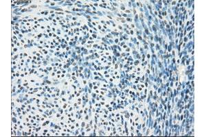Immunohistochemical staining of paraffin-embedded Ovary tissue using anti-PPP5Cmouse monoclonal antibody. (PP5 Antikörper)