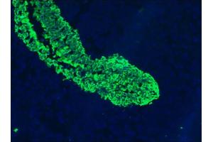 Image no. 3 for anti-Keratin 5/8 (KRT5/8) antibody (ABIN335325) (Keratin 5/8 Antikörper)