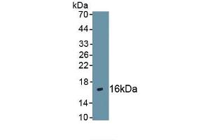 Detection of Recombinant CXCR4, Human using Polyclonal Antibody to Chemokine C-X-C-Motif Receptor 4 (CXCR4) (CXCR4 Antikörper  (AA 262-352))