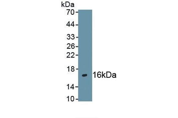 CXCR4 antibody  (AA 262-352)