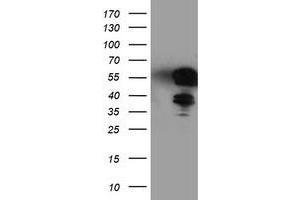 Western Blotting (WB) image for anti-T-Cell Acute Lymphocytic Leukemia 1 (TAL1) antibody (ABIN1501288) (TAL1 Antikörper)
