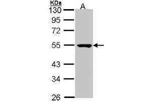 WB Image Sample (30 ug of whole cell lysate) A: Molt-4 , 10 % SDS PAGE antibody diluted at 1:1000 (PSKH1 Antikörper)